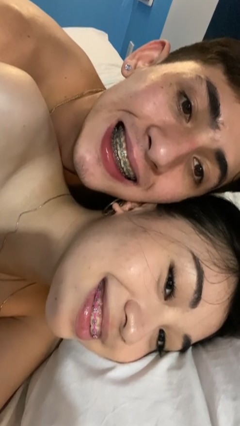 inudjust ba yung brace o yung naka baon sa likod